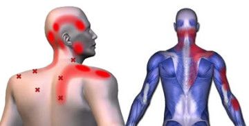 jaw-neck-shoulder-pain Shoulder Pain